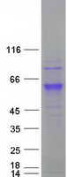 CCT6A Protein - Purified recombinant protein CCT6A was analyzed by SDS-PAGE gel and Coomassie Blue Staining