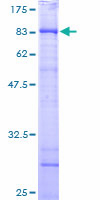 CCT6B Protein - 12.5% SDS-PAGE of human CCT6B stained with Coomassie Blue