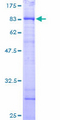 CCT6B Protein - 12.5% SDS-PAGE of human CCT6B stained with Coomassie Blue