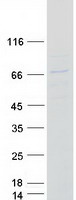 CCT6B Protein - Purified recombinant protein CCT6B was analyzed by SDS-PAGE gel and Coomassie Blue Staining