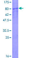 CCT7 Protein - 12.5% SDS-PAGE of human CCT7 stained with Coomassie Blue