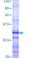 CCT7 Protein - 12.5% SDS-PAGE Stained with Coomassie Blue.
