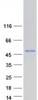 CCT7 Protein - Purified recombinant protein CCT7 was analyzed by SDS-PAGE gel and Coomassie Blue Staining