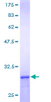 CCT8 Protein - 12.5% SDS-PAGE of human CCT8 stained with Coomassie Blue