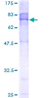 CCT8L2 Protein - 12.5% SDS-PAGE of human CESK1 stained with Coomassie Blue
