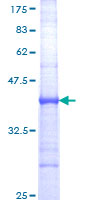 CD101 Protein - 12.5% SDS-PAGE Stained with Coomassie Blue.