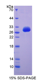 CD101 Protein - Recombinant  Immunoglobulin Superfamily, Member 2 By SDS-PAGE