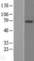 CD105 Protein - Western validation with an anti-DDK antibody * L: Control HEK293 lysate R: Over-expression lysate