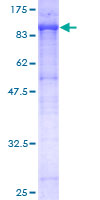 CD105 Protein - 12.5% SDS-PAGE of human ENG stained with Coomassie Blue