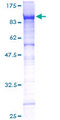 CD105 Protein - 12.5% SDS-PAGE of human ENG stained with Coomassie Blue