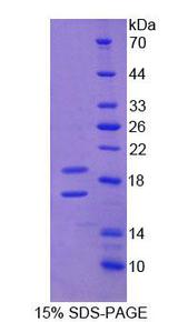 CD105 Protein - Recombinant Endoglin By SDS-PAGE