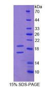 CD105 Protein - Recombinant Endoglin By SDS-PAGE