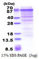 CD105 Protein