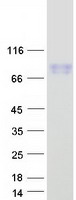 CD105 Protein - Purified recombinant protein ENG was analyzed by SDS-PAGE gel and Coomassie Blue Staining