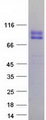 CD105 Protein - Purified recombinant protein ENG was analyzed by SDS-PAGE gel and Coomassie Blue Staining