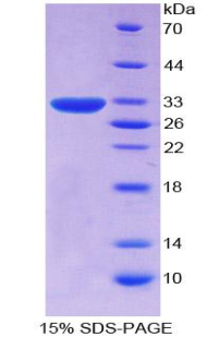 CD109 Protein - Recombinant Cluster Of Differentiation 109 By SDS-PAGE
