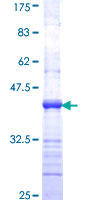 CD118 / LIF Receptor Alpha Protein - 12.5% SDS-PAGE Stained with Coomassie Blue.