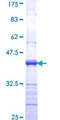 CD118 / LIF Receptor Alpha Protein - 12.5% SDS-PAGE Stained with Coomassie Blue.