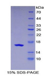 CD118 / LIF Receptor Alpha Protein - Recombinant Leukemia Inhibitory Factor Receptor By SDS-PAGE