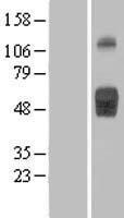 CD121b / IL1R2 Protein - Western validation with an anti-DDK antibody * L: Control HEK293 lysate R: Over-expression lysate