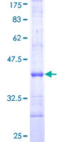 CD121b / IL1R2 Protein - 12.5% SDS-PAGE Stained with Coomassie Blue.