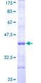 CD121b / IL1R2 Protein - 12.5% SDS-PAGE Stained with Coomassie Blue.