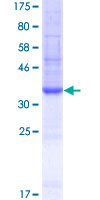 CD135 / FLT3 Protein - 12.5% SDS-PAGE Stained with Coomassie Blue.