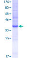 CD135 / FLT3 Protein - 12.5% SDS-PAGE Stained with Coomassie Blue.