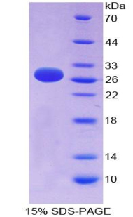 CD135 / FLT3 Protein - Recombinant FMS Like Tyrosine Kinase 3 By SDS-PAGE