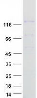 CD135 / FLT3 Protein - Purified recombinant protein FLT3 was analyzed by SDS-PAGE gel and Coomassie Blue Staining