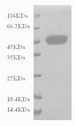 CD14 Protein - (Tris-Glycine gel) Discontinuous SDS-PAGE (reduced) with 5% enrichment gel and 15% separation gel.