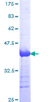 CD144 / CDH5 / VE Cadherin Protein - 12.5% SDS-PAGE Stained with Coomassie Blue