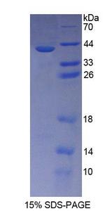 CD144 / CDH5 / VE Cadherin Protein - Recombinant  Cadherin 5 By SDS-PAGE