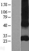 CD151 Protein - Western validation with an anti-DDK antibody * L: Control HEK293 lysate R: Over-expression lysate