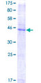 CD151 Protein - 12.5% SDS-PAGE of human CD151 stained with Coomassie Blue