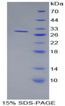 CD157 Protein - Recombinant Bone Marrow Stromal Cell Antigen 1 By SDS-PAGE