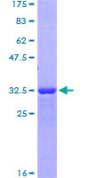 CD163 Protein - 12.5% SDS-PAGE Stained with Coomassie Blue.