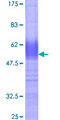 CD164 Protein - 12.5% SDS-PAGE of human CD164 stained with Coomassie Blue