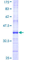 CD164 Protein - 12.5% SDS-PAGE Stained with Coomassie Blue.
