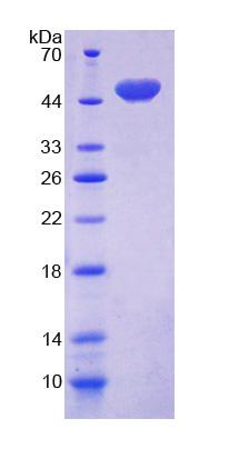 CD164 Protein - Recombinant Cluster Of Differentiation 164 By SDS-PAGE