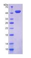 CD164 Protein - Recombinant Cluster Of Differentiation 164 By SDS-PAGE