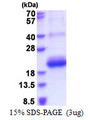 CD164L2 Protein
