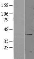 CD177 Protein - Western validation with an anti-DDK antibody * L: Control HEK293 lysate R: Over-expression lysate
