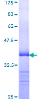 CD177 Protein - 12.5% SDS-PAGE Stained with Coomassie Blue