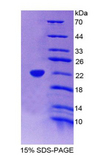 CD177 Protein - Recombinant Neutrophil Specific Antigen 1 By SDS-PAGE