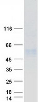 CD177 Protein - Purified recombinant protein CD177 was analyzed by SDS-PAGE gel and Coomassie Blue Staining
