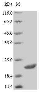 CD19 Protein - (Tris-Glycine gel) Discontinuous SDS-PAGE (reduced) with 5% enrichment gel and 15% separation gel.