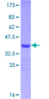 CD19 Protein - 12.5% SDS-PAGE Stained with Coomassie Blue.