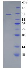 CD19 Protein - Recombinant Cluster Of Differentiation 19 By SDS-PAGE