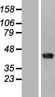 CD1B Protein - Western validation with an anti-DDK antibody * L: Control HEK293 lysate R: Over-expression lysate